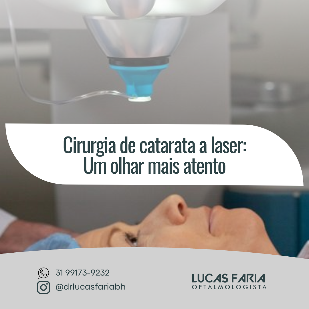 Cirurgia De Catarata A Laser Um Olhar Mais Atento Lucas Tavares Faria