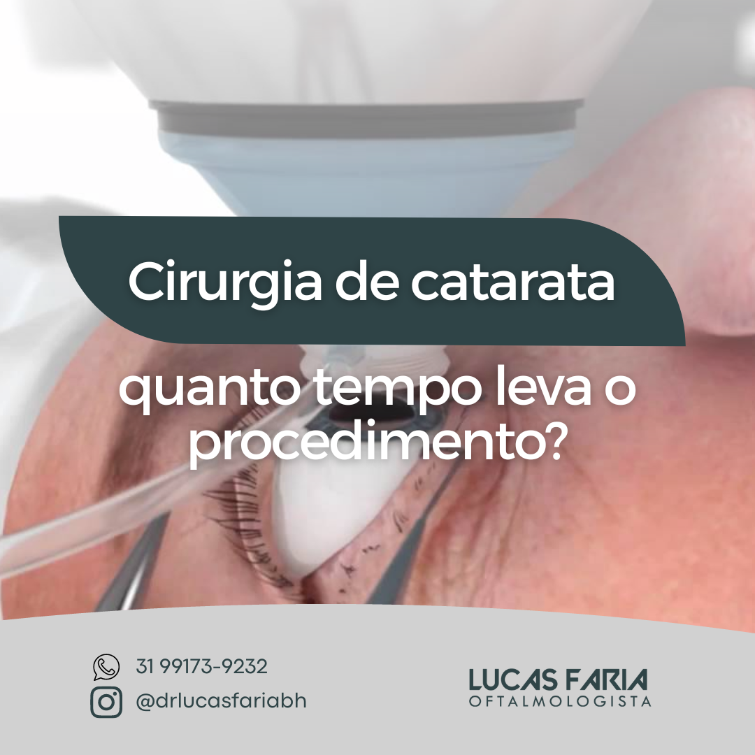 Cirurgia De Catarata Quanto Tempo Leva O Procedimento Lucas Tavares