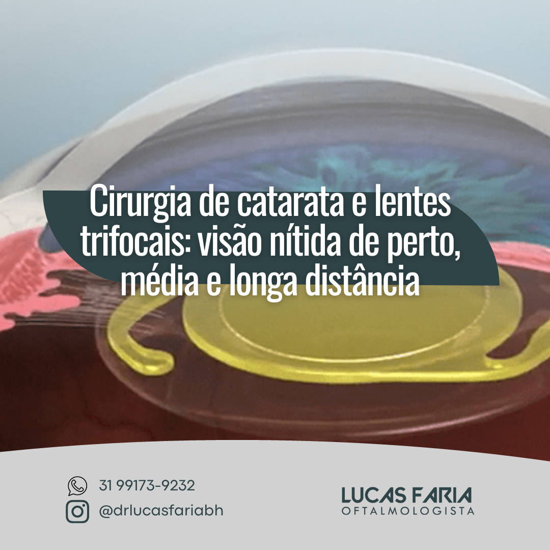 Cirurgia de catarata e lentes trifocais: visão nítida de perto